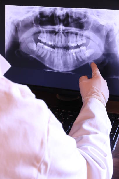 Best Emergency Broken Tooth Repair in Aptos Hills Larkin Valley, CA