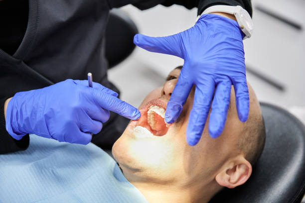 Best Emergency Dental Care for Trauma or Injury in Aptos Hills Larkin Valley, CA